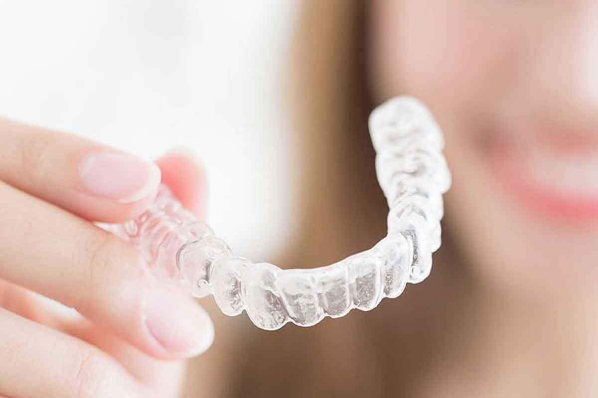 Invisalign Help