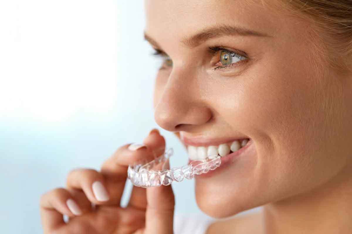 Invisalign in Brooklyn