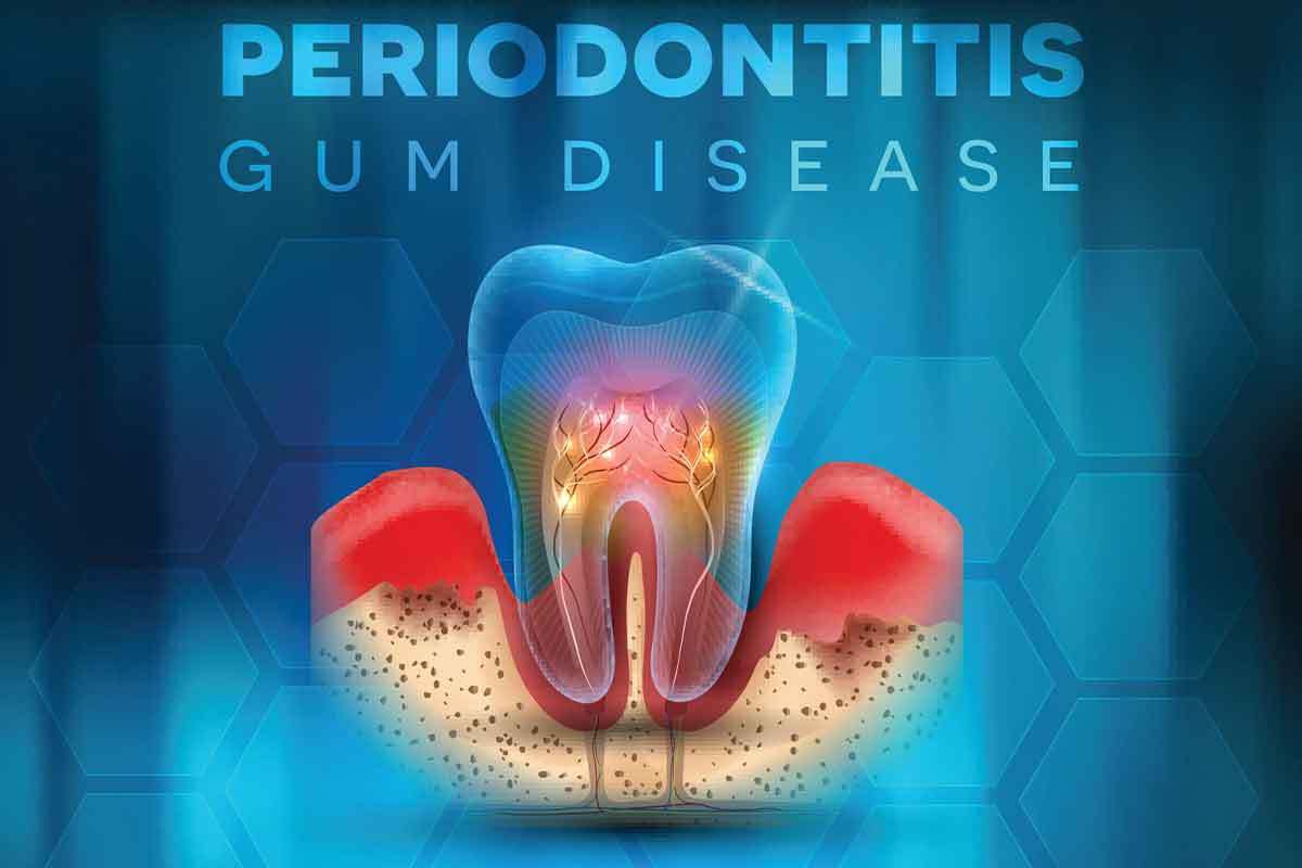 Periodontist in Brooklyn 11229 Periodontics near you in 11229