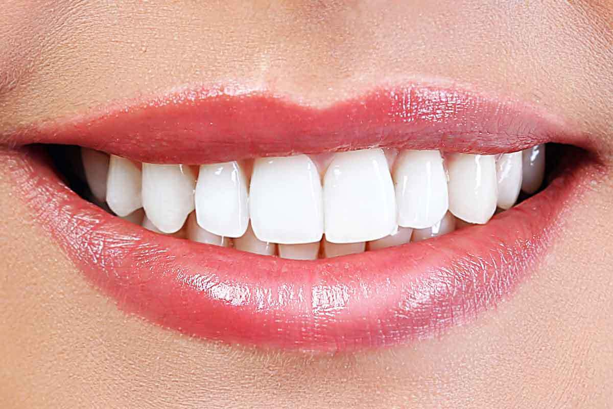 Teeth Whitening – An Incredible Look