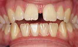 Dentist Near Me Brooklyn 11229  . More Than 15 Years Of Superior Dental Providing The Finest Dental Care To The Members Of The Brooklyn Ny, Sheepshead Bay Community, And Surrounding Environs.