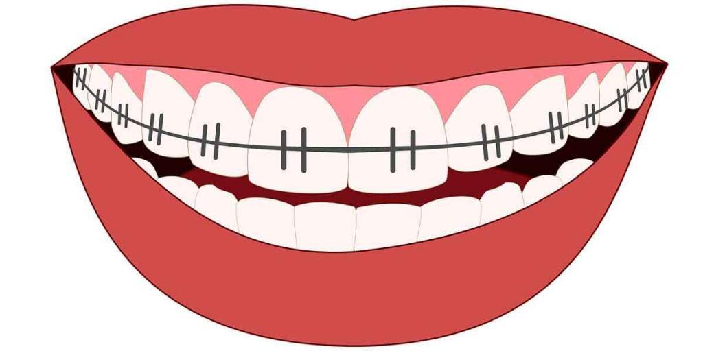 Brooklyn Dental Tips: The Benefits of Preventative Dentistry