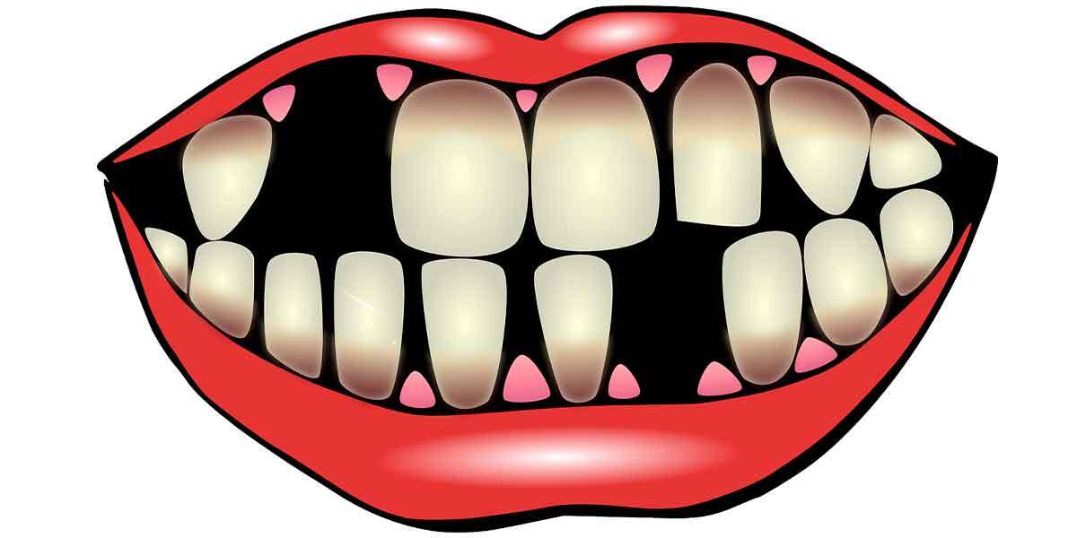Understanding Common Restorative Dental Procedures