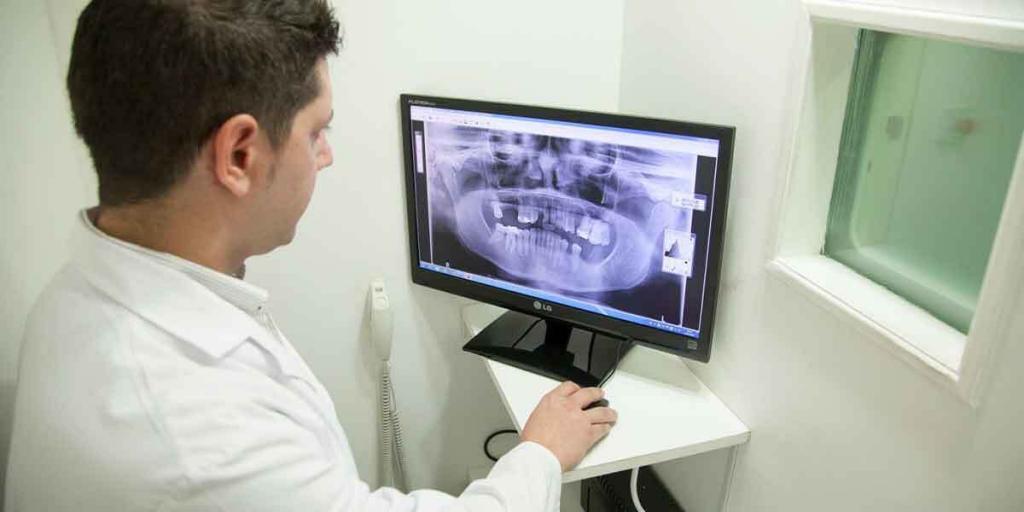 Quality Dental Care Brooklyn Guide: The Need for Fixed Dental Bridges